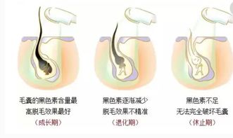 吉林长春脱毛仪器价格,吉林长春脱毛仪器厂家哪家好