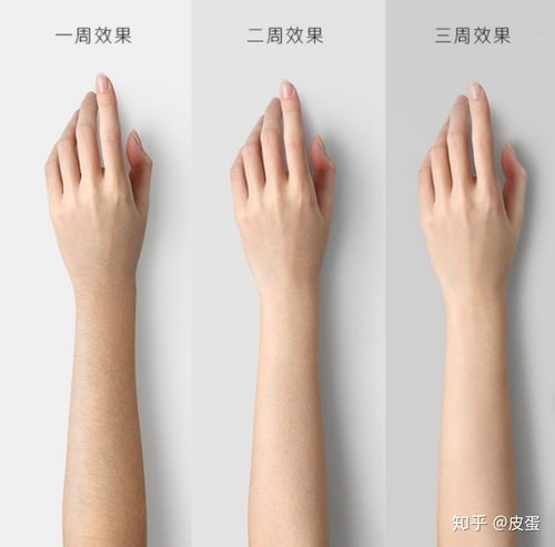 家用脱毛仪能永久脱毛吗 脱毛仪哪个牌子好 丨jovs amiro 慕金 ulike等脱毛仪品牌指南