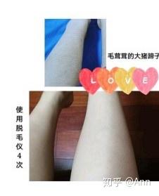 lescolton脱毛仪脱唇毛好用吗