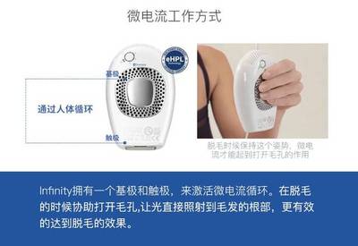 闲人徐大姨 | 给对激光脱毛完全摸不着头脑的朋友