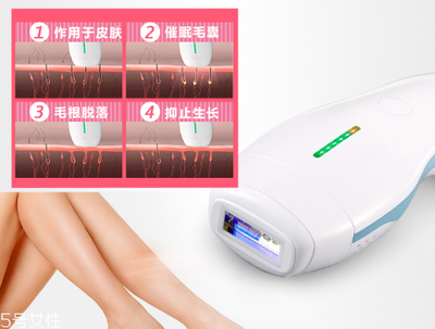 deess脱毛仪多少钱